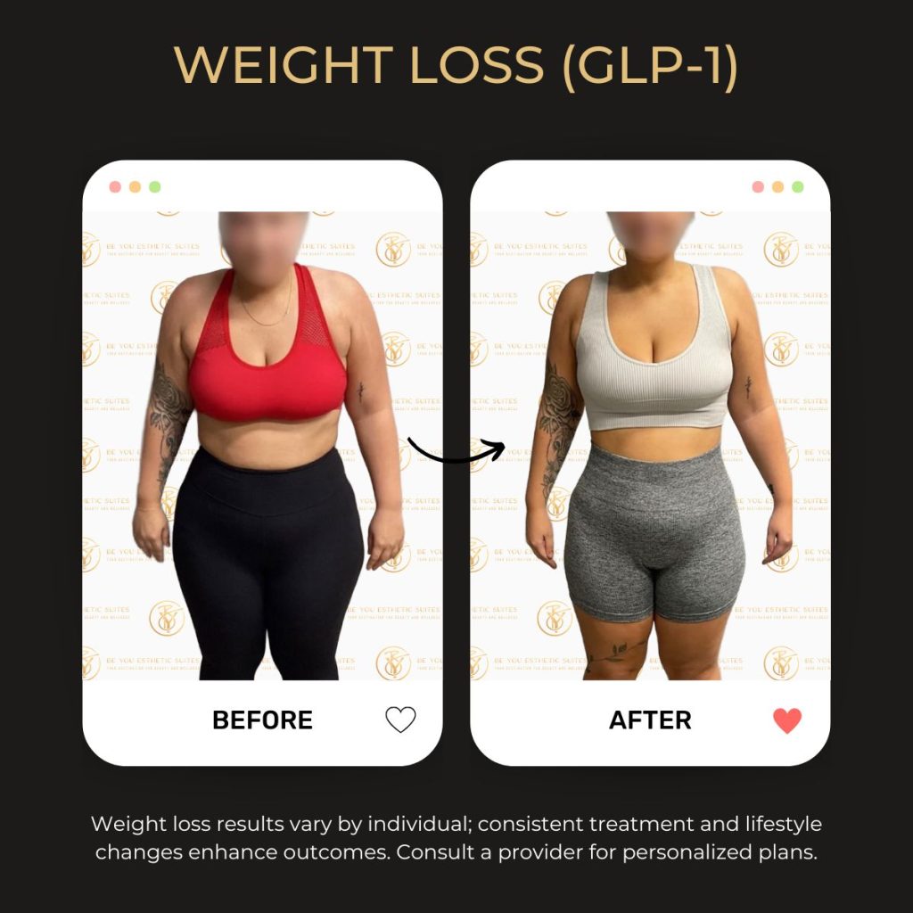 Before and after image showing sustainable post-surgery weight management results achieved with metabolic support at a Brooklyn med spa.