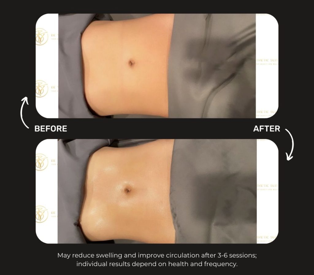 Post-surgery lymphatic drainage is the best for post-surgery recovery. Enhance your recovery time and swelling reduction with our massage therapy. Be You Esthetic Suites is the top rated med spa in Brooklyn, sitting next to Park Slope, but located in Flatbush. Med spa near park slope, body contouring in park slope, body sculpting in Brooklyn, lip fillers in Brooklyn, Brooklyn lymphatic drainage massage, Med spa in Brooklyn, Brooklyn Med spa, botox in Brooklyn.