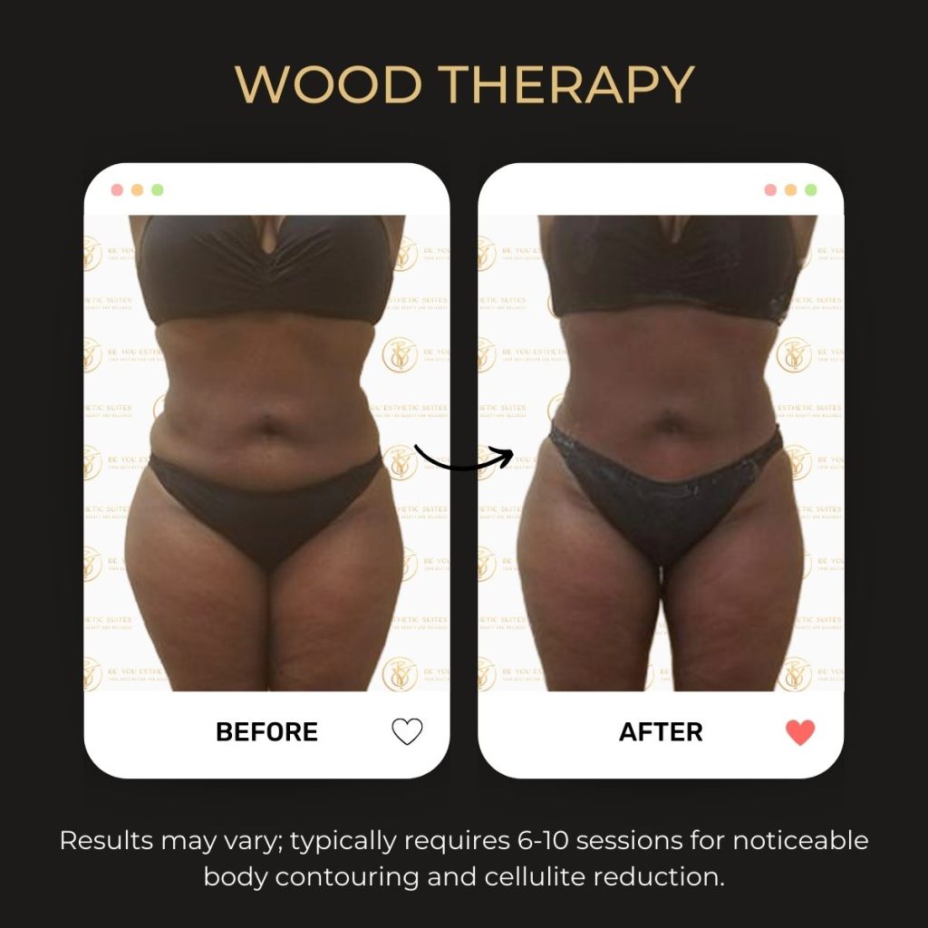 Wood Therapy Before & After - 3