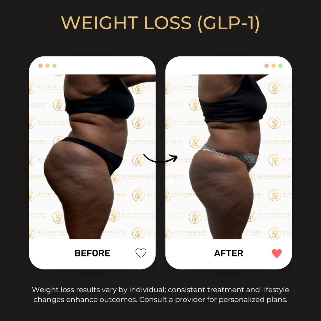 Weight Loss Before & After - 3