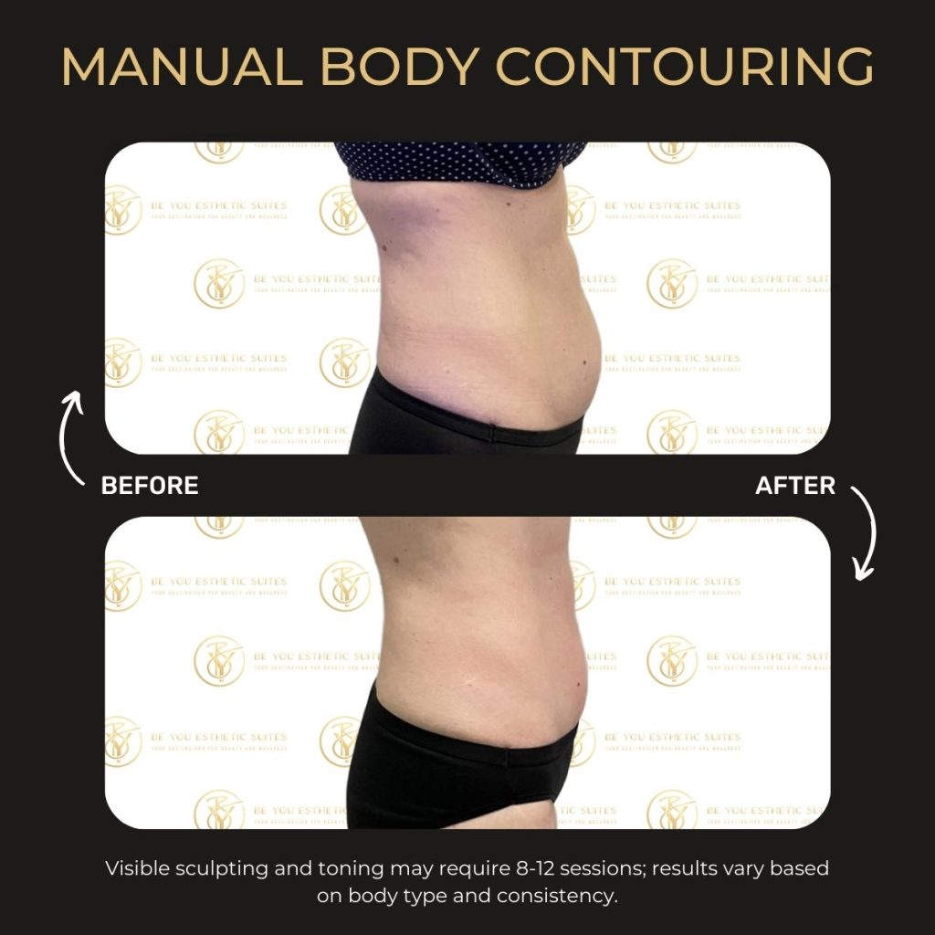 Be You Esthetic Suites is the top rated med spa in Brooklyn, offering affordable med spa services in Brooklyn. Post surgery healing services like lymphatic drainage massage near Park Slope, red light therapy in Brooklyn, and more to help you recover from your surgery quickly. They do also offer Brooklyn body sculpting treatments like ultrasonic cavitation in Brooklyn, wood therapy massage near Park Slope, and weight loss treatments in Brooklyn like Semaglutide and Tirzepatide. chemical peels in Brooklyn, acne treatments in Brooklyn, microdermabrasion near Park Slope, laser hair removal in Brooklyn, Brooklyn lip fillers, body fillers in Brooklyn, Brooklyn laser hair removal, laser hair near Park slope. Post-weight loss, Brooklyn contouring, skin tightening