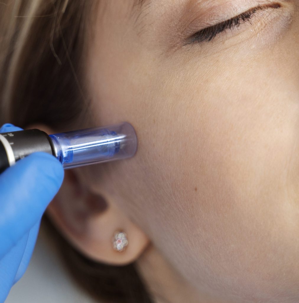 Be You Esthetic Suites is the top rated med spa suites in Brooklyn, offering affordable med spa services in Brooklyn from independent service providers. Post surgery healing services like lymphatic drainage massage near Park Slope, red light therapy in Brooklyn, and more to help you recover from your surgery quickly. They do also offer Brooklyn body sculpting treatments like ultrasonic cavitation in Brooklyn, wood therapy massage near Park Slope, and weight loss treatments in Brooklyn like Semaglutide and Tirzepatide. chemical peels in Brooklyn, acne treatments in Brooklyn, microdermabrasion near Park Slope, laser hair removal in Brooklyn, Brooklyn lip fillers, body fillers in Brooklyn, Brooklyn laser hair removal, laser hair near Park slope, microneedling in brooklyn, waxing in brooklyn. Microneedling active acne, acne treatment, inflamed skin