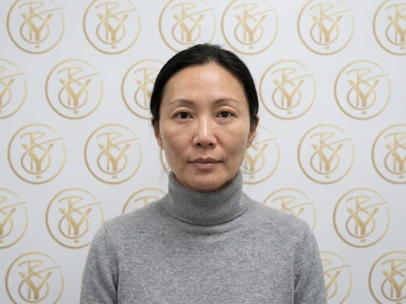 Dermal Fillers — after