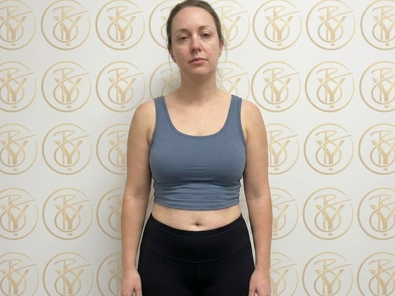 Ultrasonic Cavitation — after