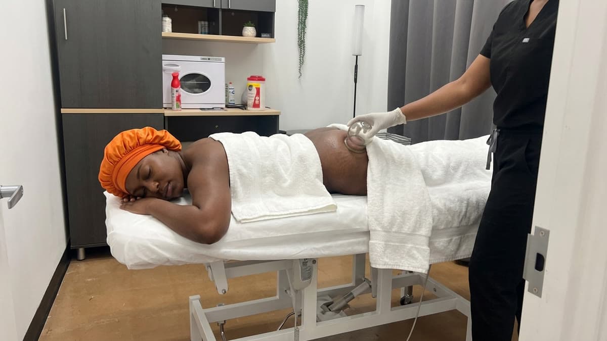 Before-and-after comparison of Vacuum Butt Lift Therapy results at Be You Esthetic Suites in Brooklyn, NY.