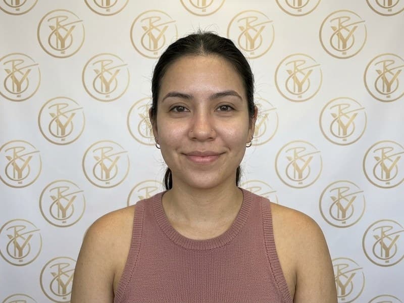 Acne Treatment — after