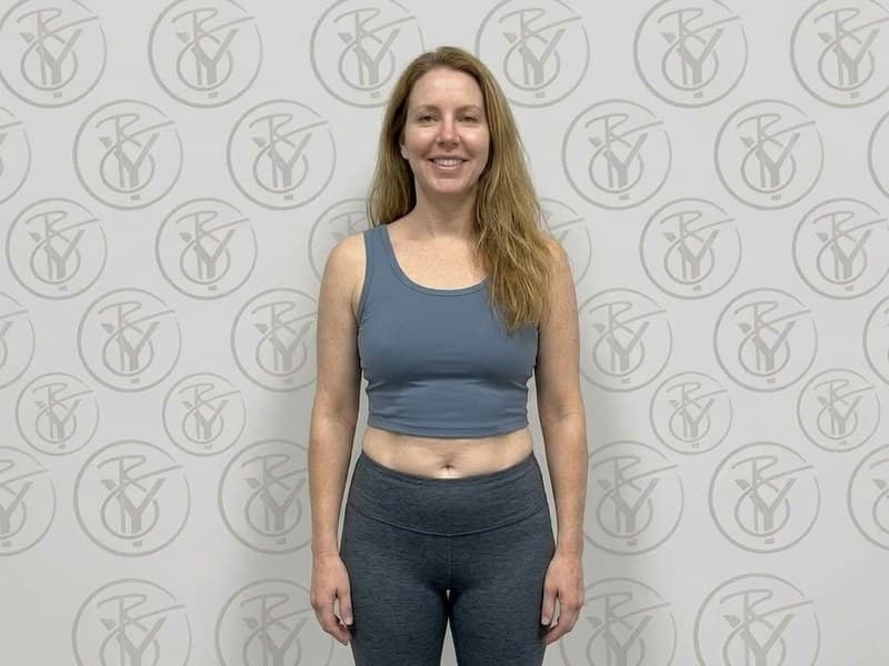 Ultrasonic Cavitation — after
