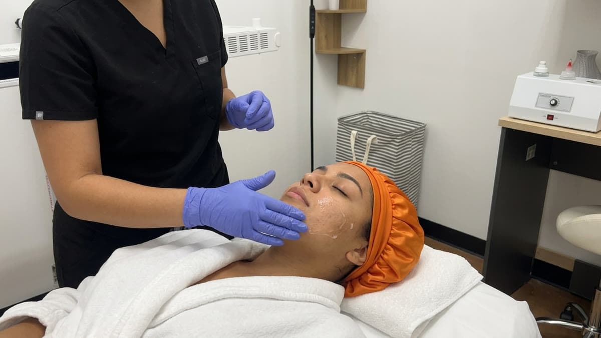 Before and after acne treatment images showcasing skin improvement at Be You Esthetics Suites.