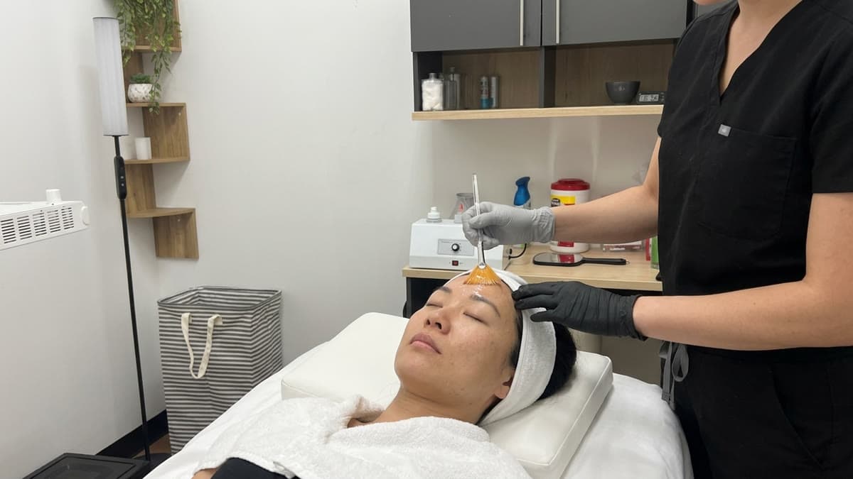 Chemical peels at Be You Esthetic Suites.