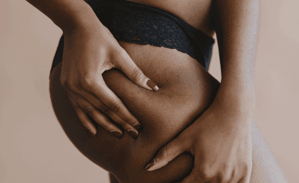 Stubborn cellulite — manual body contouring.