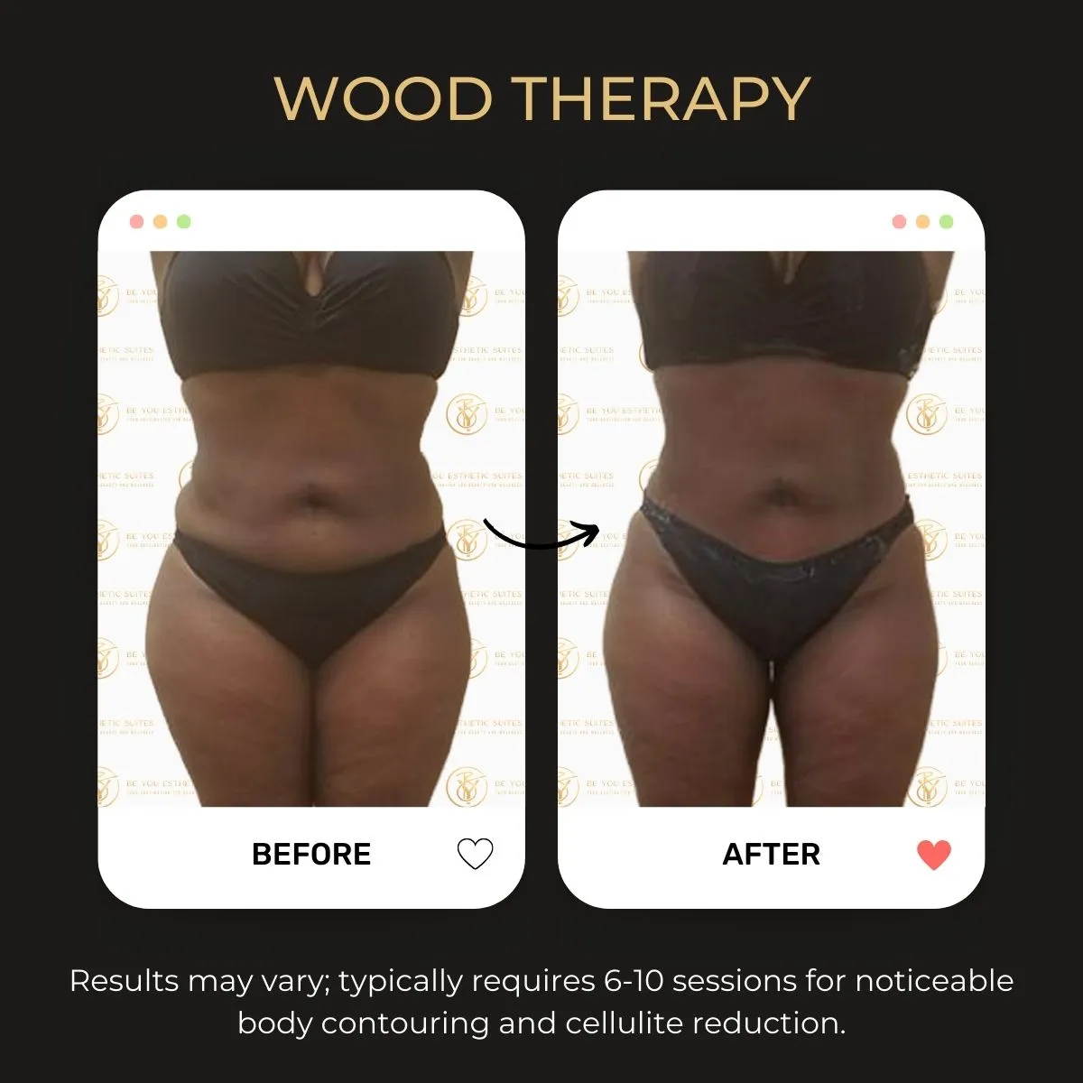 Before and after wood therapy at Be You Esthetic Suites.