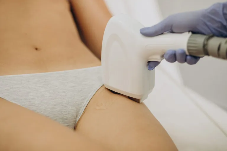Laser Hair Removal in Brooklyn: Everything You Need to Know Before Your First Session — Be You Esthetic Suites Brooklyn