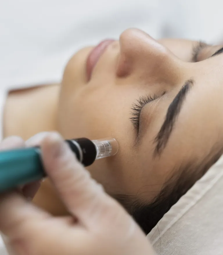 Microneedling Myths Debunked: Separating Facts from Fiction About Skin Needling — Be You Esthetic Suites Brooklyn
