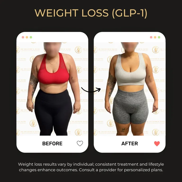 Weight Loss Shots in Brooklyn: Comparing GLP-1 Options at Be You Esthetic Suites — Be You Esthetic Suites Brooklyn