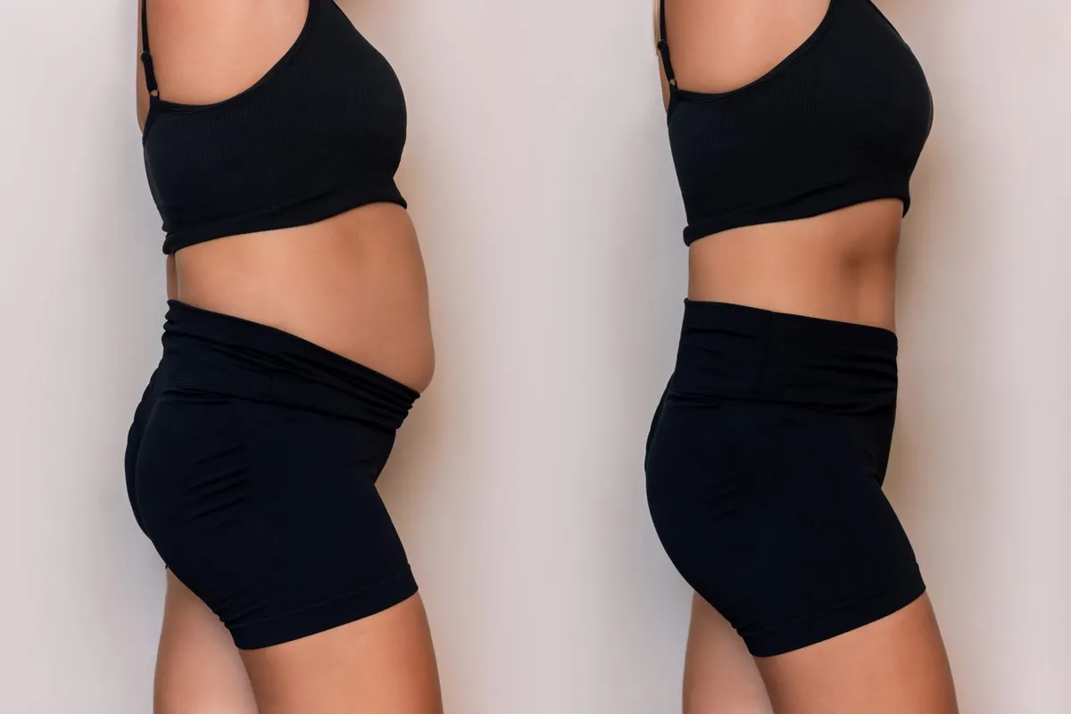 Weight Management in Brooklyn: How Ozempic is Changing the Game — Be You Esthetic Suites Brooklyn