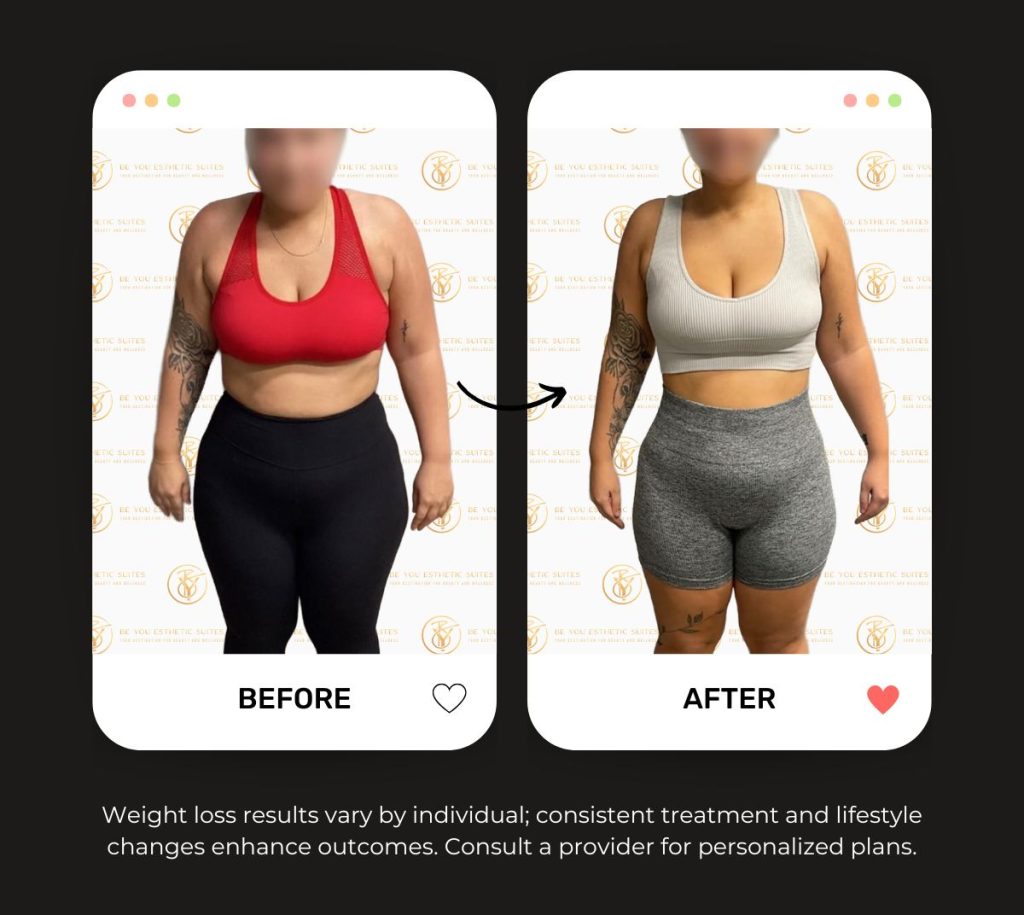 Experience Be You Esthetic Suites Tirzepatide Treatment as an effective weight loss solution. Explore how Tirzepatide can help manage appetite regulation and metabolic health. Explore the other weight loss options Be You Esthetic Suites offers in brooklyn. Body sculpting, botox, chemical peel, facials, glp-1, laser hair removal lip fillers, lymphatic drainage massage, med spa, red light therapy, semaglutide