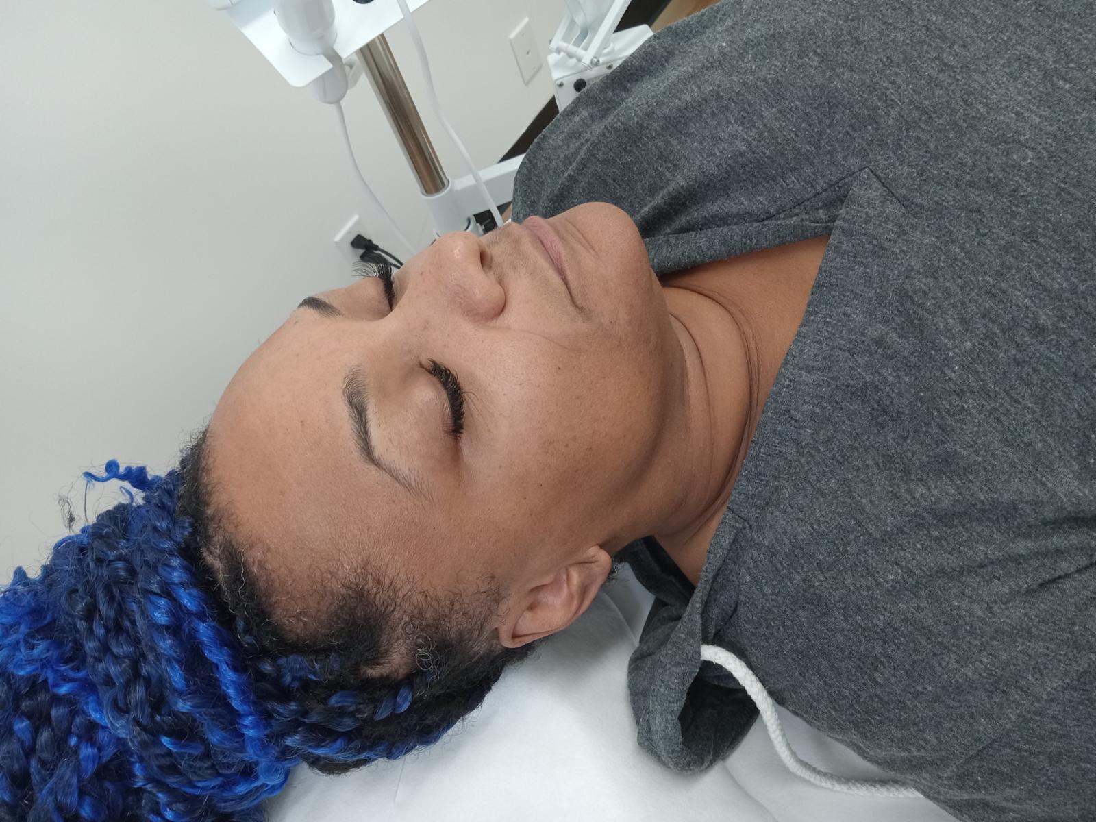 Microdermabrasion facial in Brooklyn, Be You Esthetic Suites is the premier choice for Brooklyn skincare for deep exfoliation and skin rejuvenation. Brooklyn med spa, brooklyn chemical peel, facials in Brooklyn, red light therapy in brooklyn.