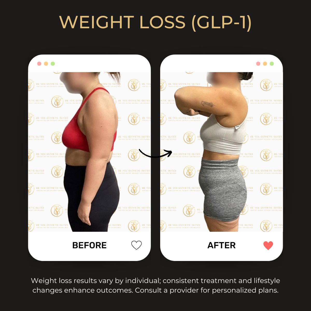 GLP-1 therapy guide, weight loss treatment, med spa in Brooklyn, Be You Esthetic Suites is the top rated Med spa in Brooklyn. Offering clients the best aesthetic treatments near Park Slope, including Semaglutide in Brooklyn, weight loss treatments in Brooklyn, facial treatments in Brooklyn, Brooklyn body sculpting, Chemical peels in brooklyn, Brooklyn botox treatments, affordable brooklyn med spa, lymphatic drainage massage in Brooklyn, non invasive treatments in Brooklyn.