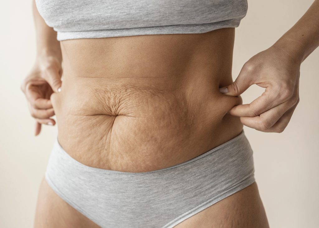 Be You Esthetic Suites is the top rated med spa in Brooklyn, offering affordable med spa services in Brooklyn. Post surgery healing services like lymphatic drainage massage near Park Slope, red light therapy in Brooklyn, and more to help you recover from your surgery quickly. They do also offer Brooklyn body sculpting treatments like ultrasonic cavitation in Brooklyn, wood therapy massage near Park Slope, and weight loss treatments in Brooklyn like Semaglutide and Tirzepatide. chemical peels in Brooklyn, acne treatments in Brooklyn, microdermabrasion near Park Slope, laser hair removal in Brooklyn, Brooklyn lip fillers, body fillers in Brooklyn, Brooklyn laser hair removal, laser hair near Park slope. Post-weight loss, Brooklyn contouring, skin tightening