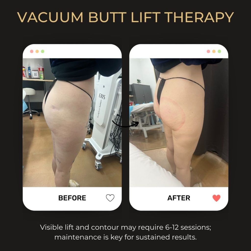 Be You Esthetic Suites is the top rated med spa suites in Brooklyn, offering affordable med spa services in Brooklyn from independent service providers. Post surgery healing services like lymphatic drainage massage near Park Slope, red light therapy in Brooklyn, and more to help you recover from your surgery quickly. They do also offer Brooklyn body sculpting treatments like ultrasonic cavitation in Brooklyn, wood therapy massage near Park Slope, and weight loss treatments in Brooklyn like Semaglutide and Tirzepatide. chemical peels in Brooklyn, acne treatments in Brooklyn, microdermabrasion near Park Slope, laser hair removal in Brooklyn, Brooklyn lip fillers, body fillers in Brooklyn, Brooklyn laser hair removal, laser hair near Park slope. Body contouring comparison, butt enhancement, natural curves, non-surgical lifting