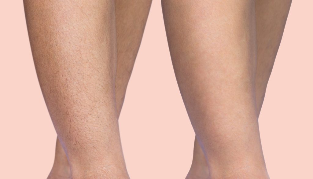 Be You Esthetic Suites is the top rated med spa suites in Brooklyn, offering affordable med spa services in Brooklyn from independent service providers. Post surgery healing services like lymphatic drainage massage near Park Slope, red light therapy in Brooklyn, and more to help you recover from your surgery quickly. They do also offer Brooklyn body sculpting treatments like ultrasonic cavitation in Brooklyn, wood therapy massage near Park Slope, and weight loss treatments in Brooklyn like Semaglutide and Tirzepatide. chemical peels in Brooklyn, acne treatments in Brooklyn, microdermabrasion near Park Slope, laser hair removal in Brooklyn, Brooklyn lip fillers, body fillers in Brooklyn, Brooklyn laser hair removal, laser hair near Park slope, microneedling in brooklyn, waxing in brooklyn. full body wax, Brooklyn waxing, smooth skin 